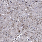 Immunohistochemical staining of human cerebral cortex shows strong positivity in neuronal processes in neuropil.