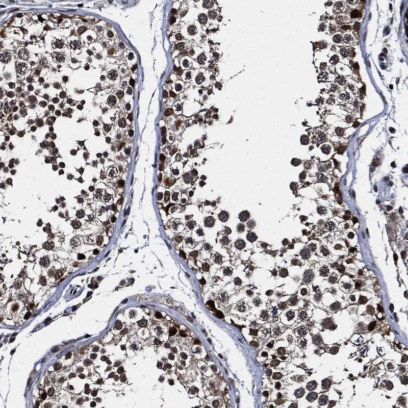 Anti-SUGT1 Antibody