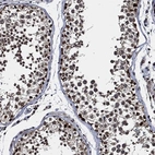 Anti-SUGT1 Antibody