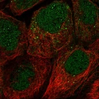 Immunofluorescent staining of human cell line A-431 shows localization to nucleus, cytosol & vesicles.