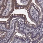 Anti-CYP2S1 Antibody