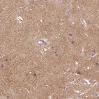 Immunohistochemical staining of human cerebral cortex shows high expression.