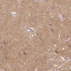 Immunohistochemical staining of human cerebral cortex shows high expression.