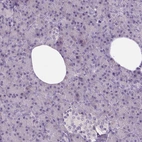 Immunohistochemical staining of human pancreas shows low expression as expected.