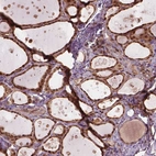 Immunohistochemical staining of human thyroid gland shows high expression.