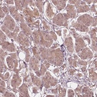 Anti-SSU72 Antibody