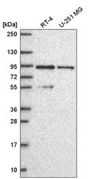 Western blot analysis in human cell line RT-4 and human cell line U-251 MG.