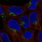 Anti-C4orf32 Antibody