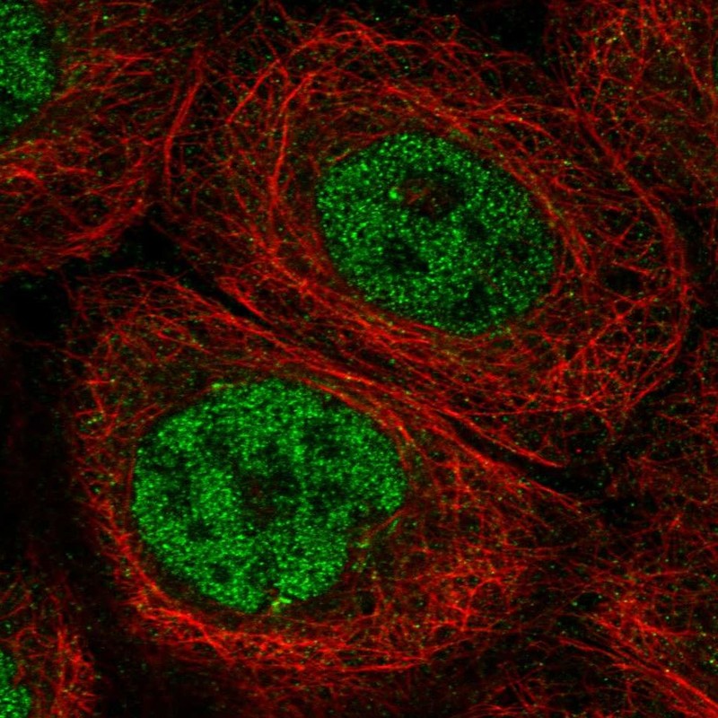 Anti-DCLRE1C Antibody