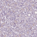 Anti-PRR35 Antibody