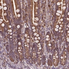 Anti-MAPK8IP3 Antibody