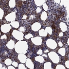 Immunohistochemical staining of human bone marrow shows high expression.