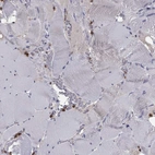 Immunohistochemical staining of human skeletal muscle shows low expression as expected.