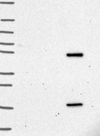 Anti-CARM1 Antibody