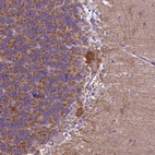 Anti-PHYHIP Antibody