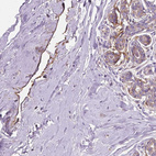 Immunohistochemical staining of human breast shows moderate positivity in lymphatic endothelial cells.
