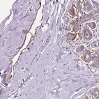Immunohistochemical staining of human breast shows moderate positivity in lymphatic endothelial cells.