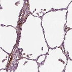 Immunohistochemical staining of human lung shows moderate cytoplasmic positivity in endothelial cells.