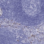 Immunohistochemical staining of human lymph node shows high expression.
