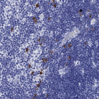 Immunohistochemical staining of human thymus shows stong nuclear and cytoplasmic positivity in cortical and medullary cells.