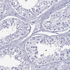 Immunohistochemical staining of human testis shows low expression as expected.