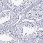 Immunohistochemical staining of human testis shows low expression as expected.