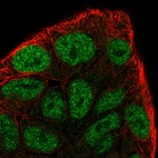 Immunofluorescent staining of human cell line RT4 shows localization to nucleoplasm.