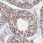 Anti-LUC7L Antibody