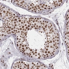Immunohistochemical staining of human testis shows strong nuclear positivity in cells in seminiferous ducts.