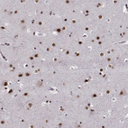 Immunohistochemical staining of human cerebral cortex shows strong nuclear positivity in neurons.