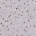 Immunohistochemical staining of human cerebral cortex shows strong nuclear positivity in neurons.