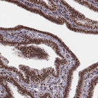 Immunohistochemical staining of human fallopian tube shows strong nuclear positivity in glandular cells.