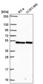 Western blot analysis in human cell line RT-4 and human cell line U-251 MG.