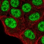 Immunofluorescent staining of human cell line MCF7 shows localization to nuclear speckles & mitochondria.