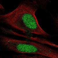 Anti-CDC73 Antibody