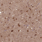 Anti-MT-CO1 Antibody