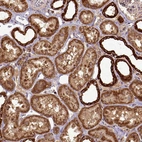 Immunohistochemical staining of human kidney shows granular cytoplasmic positivity in cells in tubules.