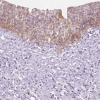 Immunohistochemical staining of human urinary bladder shows moderate cytoplasmic positivity in urothelial cells.