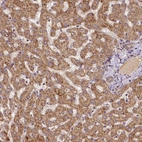 Immunohistochemical staining of human liver shows positivity in hepatocytes.