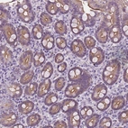 Immunohistochemical staining of human duodenum shows moderate cytoplasmic positivity in glandular cells.