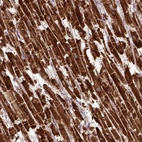 Immunohistochemical staining of human heart muscle shows positivity in cardiomyocytes.