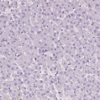 Immunohistochemical staining of human liver shows no positivity in hepatocytes as expected.