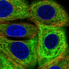 Immunofluorescent staining of human cell line MCF7 shows localization to intermediate filaments.
