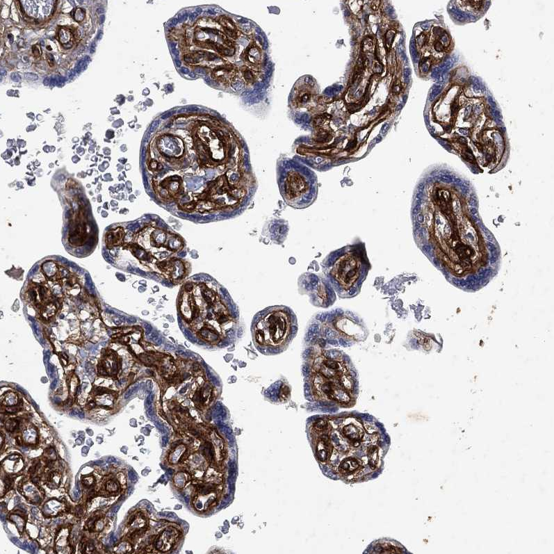 Anti-COL4A2 Antibody