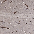 Anti-COL4A2 Antibody