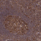 Anti-CAD Antibody