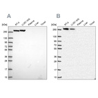 Western blot analysis using Anti-CAD antibody HPA069341 (A) shows similar pattern to independent antibody HPA057266 (B).