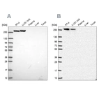 Western blot analysis using Anti-CAD antibody HPA069341 (A) shows similar pattern to independent antibody HPA057266 (B).