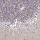 Anti-TLX3 Antibody