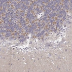 Anti-TLX3 Antibody
